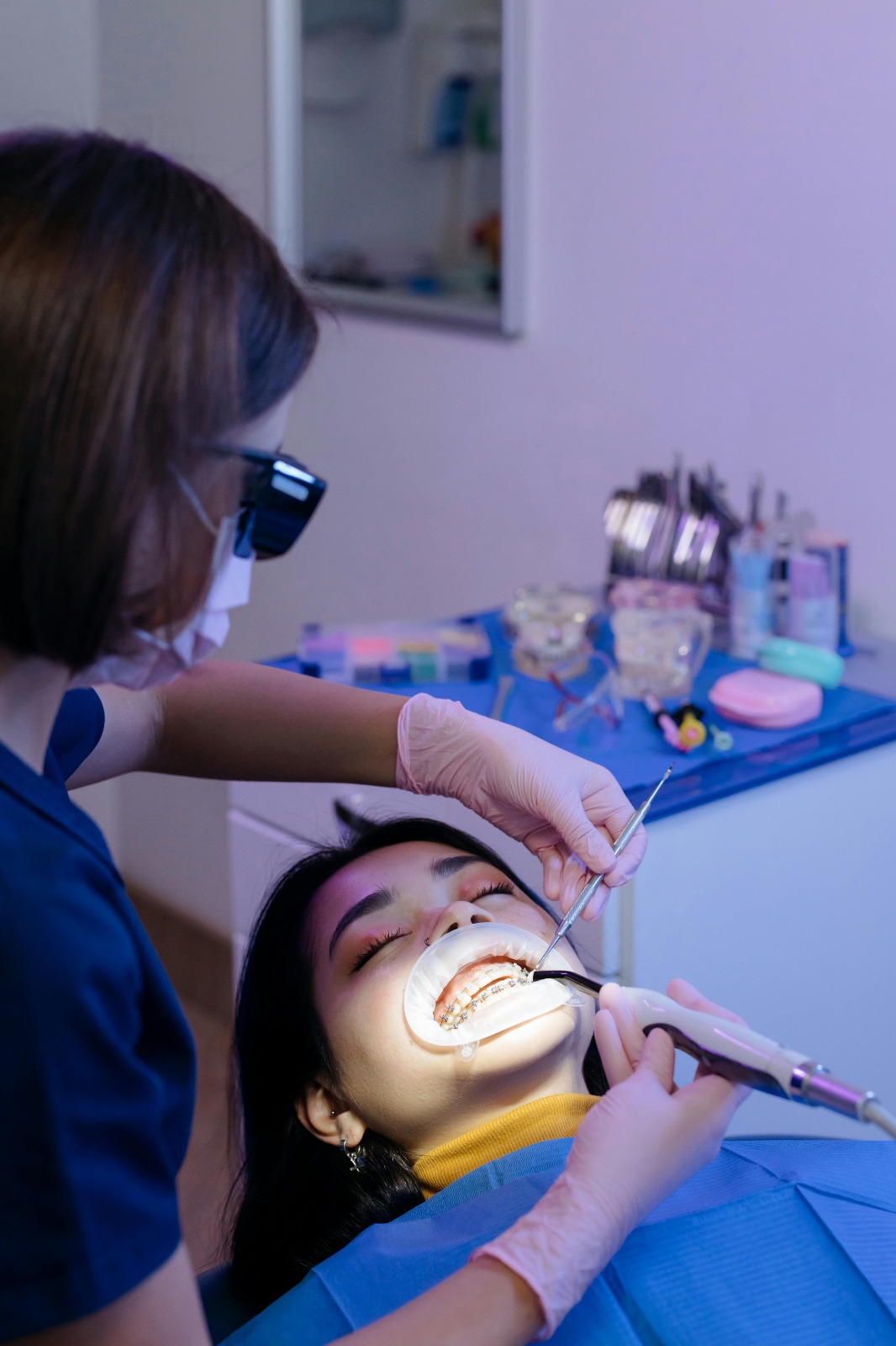 Implants Explained: The Ultimate Replacement